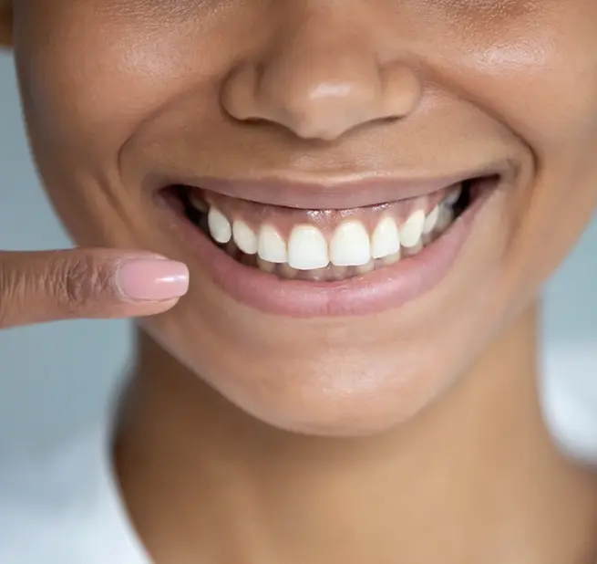 Dentist in inglewood ca smile dentist