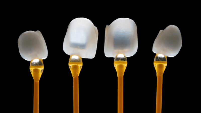 Veneers vs lumineers